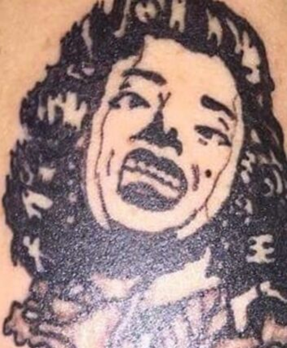Eliminación de tatuajes con láser en Clínica Miranda - Antes y después